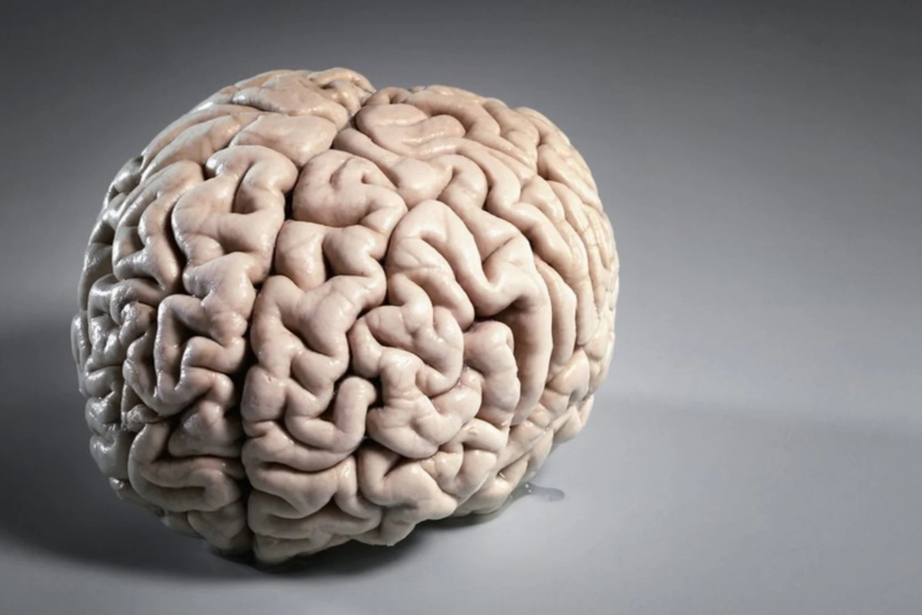 Cerebro (3)
