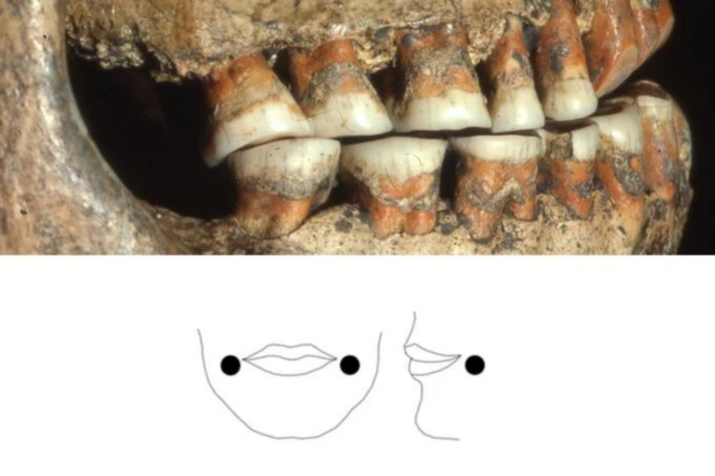 Teeth