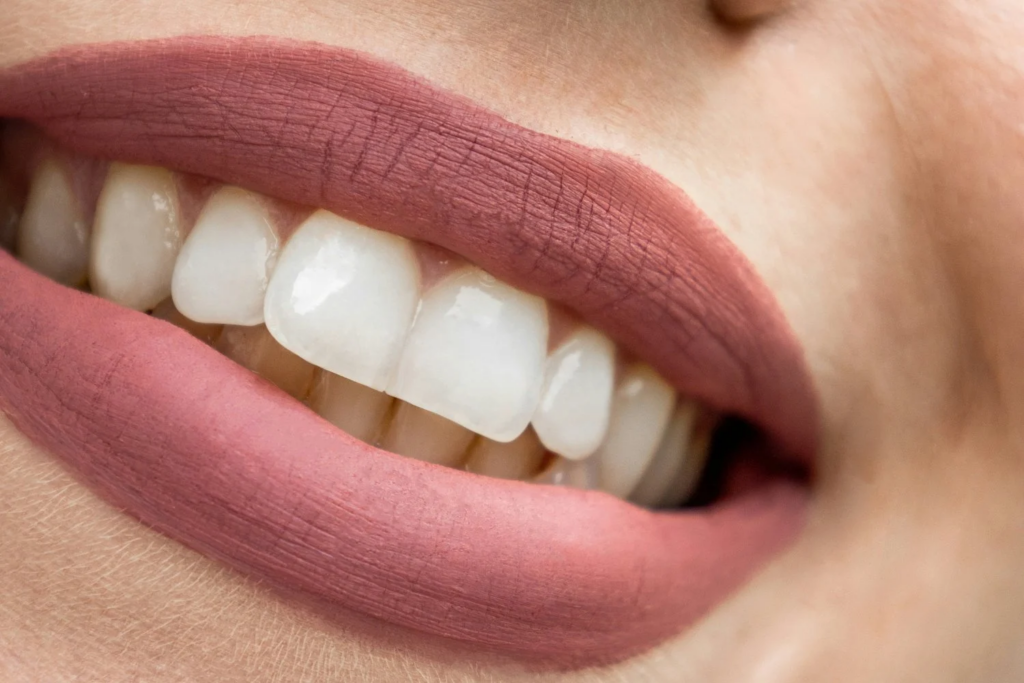 Tártaro Dental