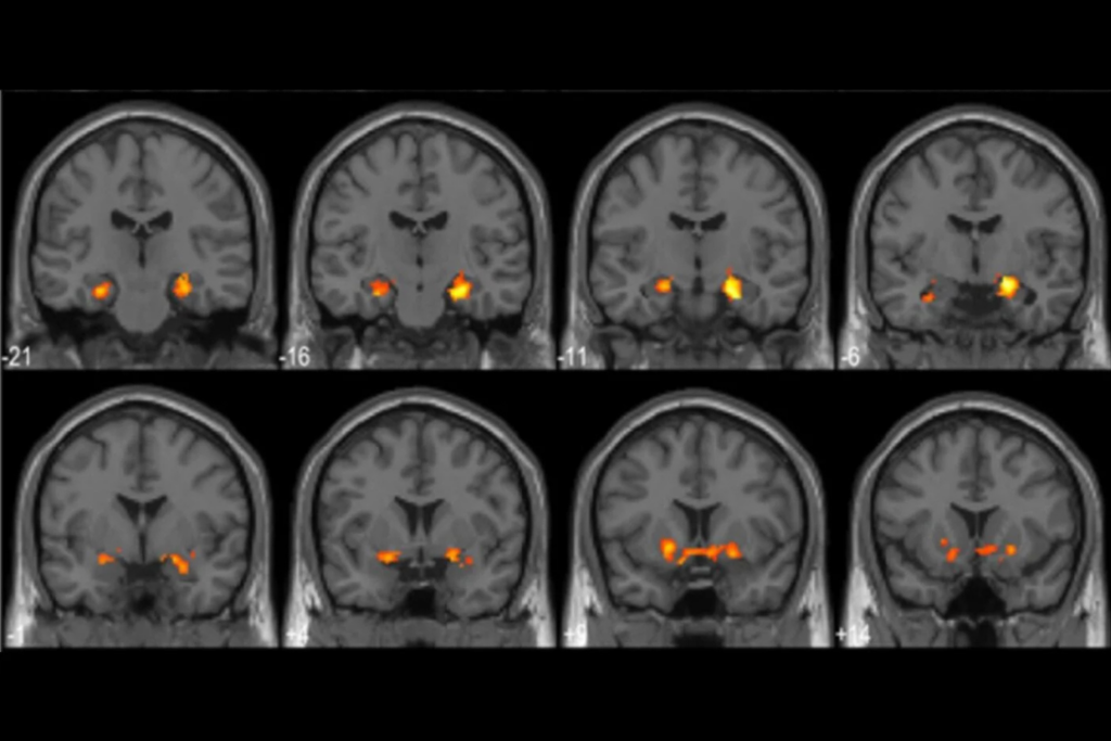 Eureka Brain