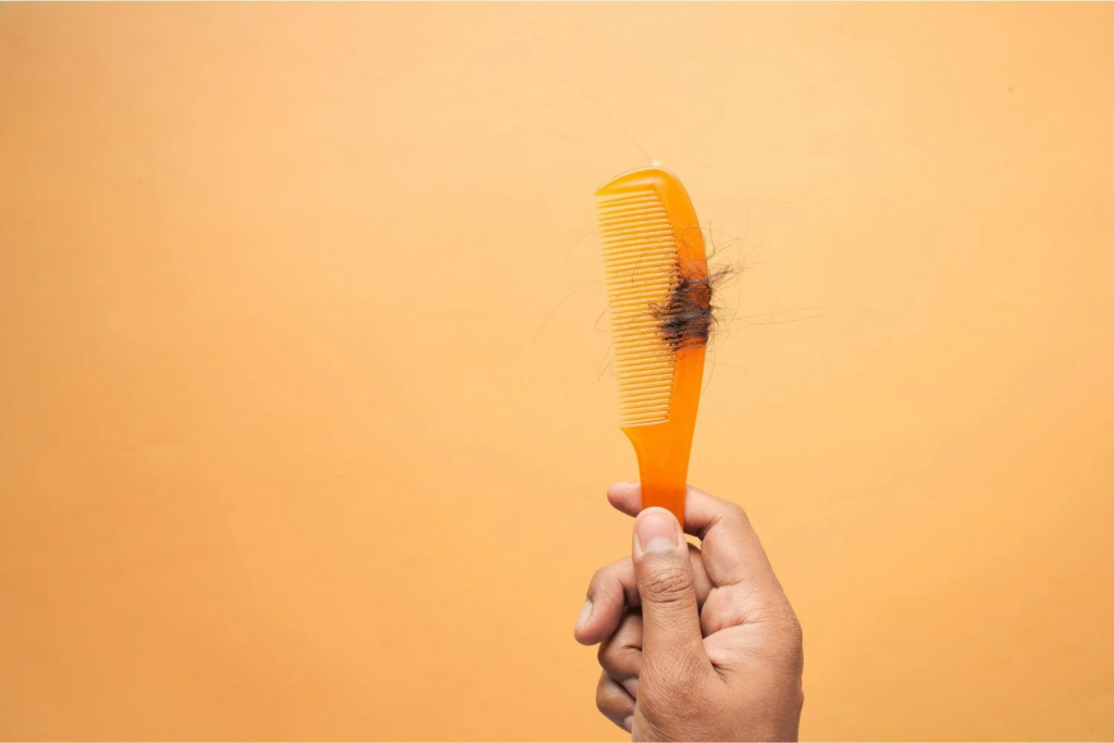 Queda De Cabelo