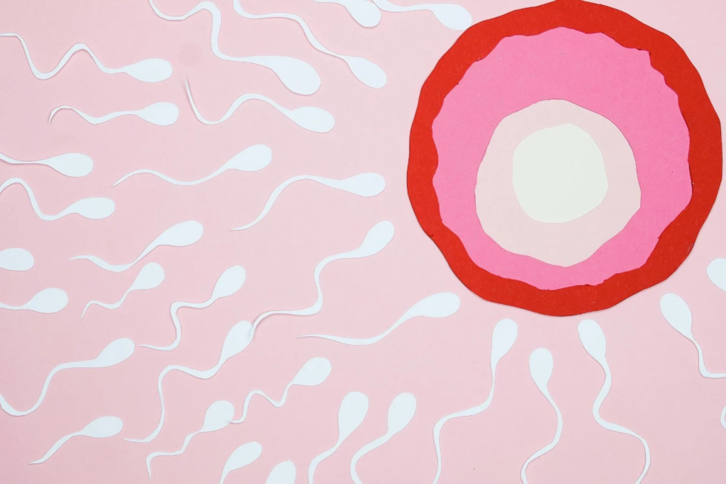 Toxoplasma