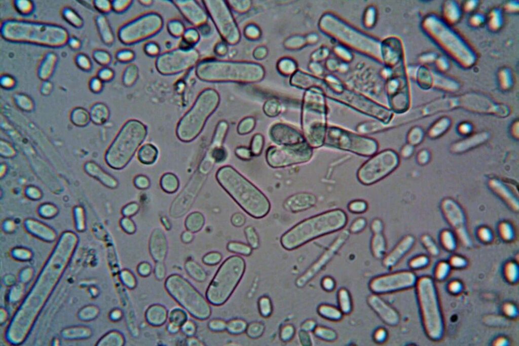 Solução para H. Pylori? Um simples chá consumido no dia a dia pode ser um forte aliado