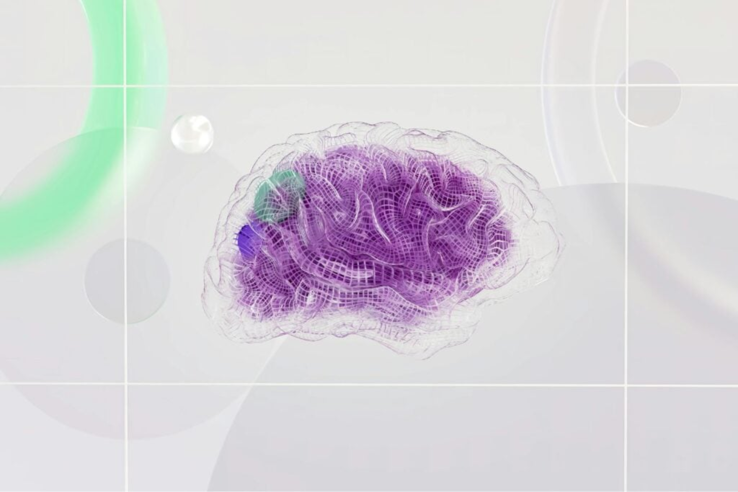 Alzheimer é Multifatorial