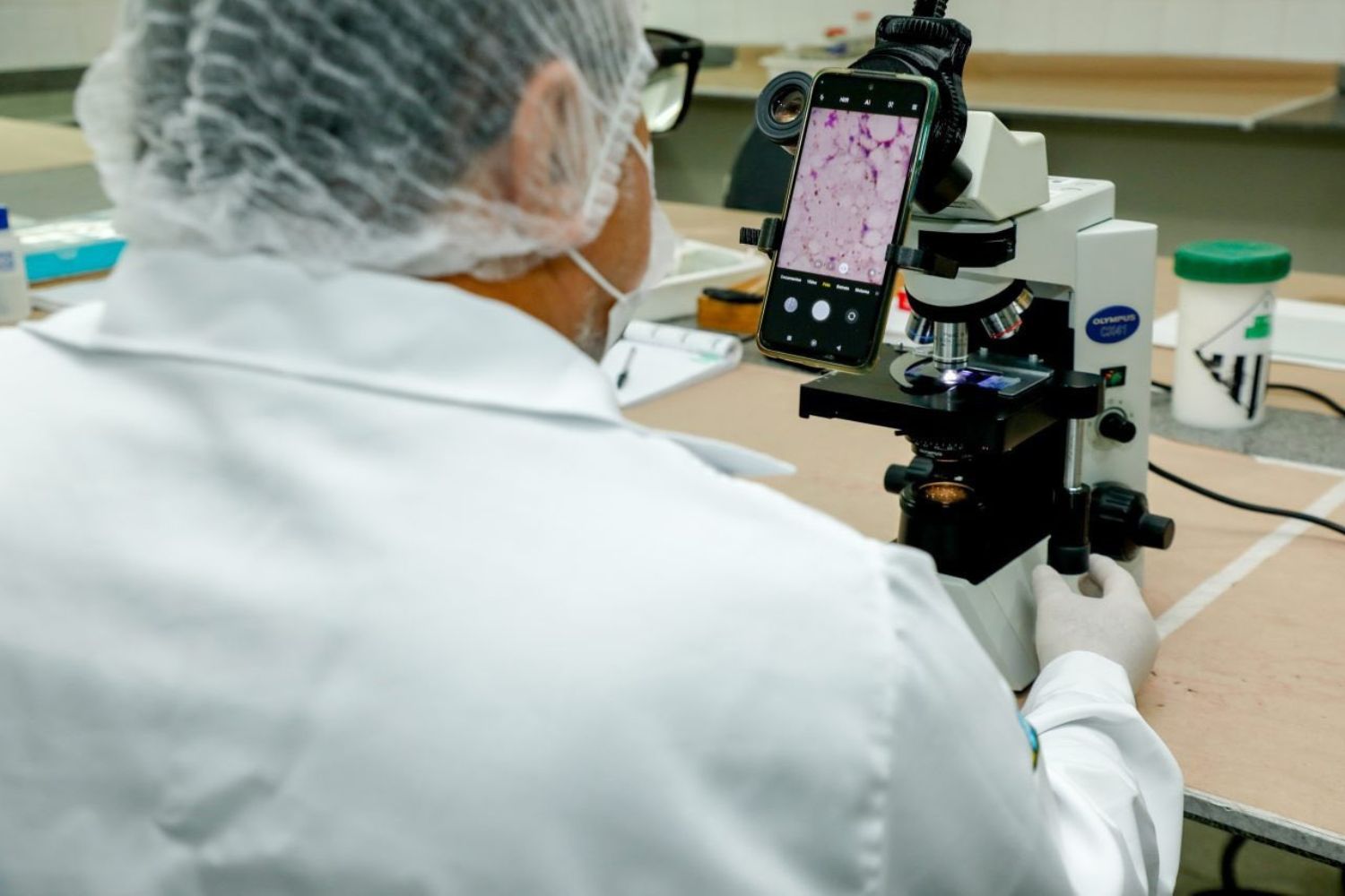 Doença de Chagas avança e expõe falhas no diagnóstico global