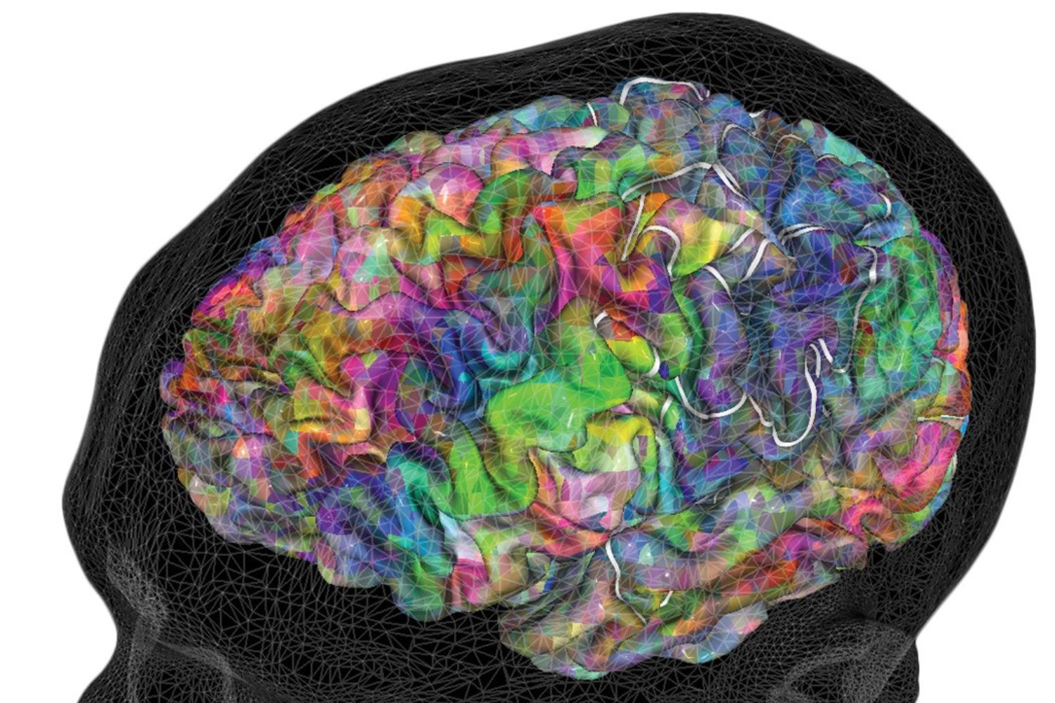 Cientistas dão passo decisivo para “ler pensamentos” com IA e ressonância
