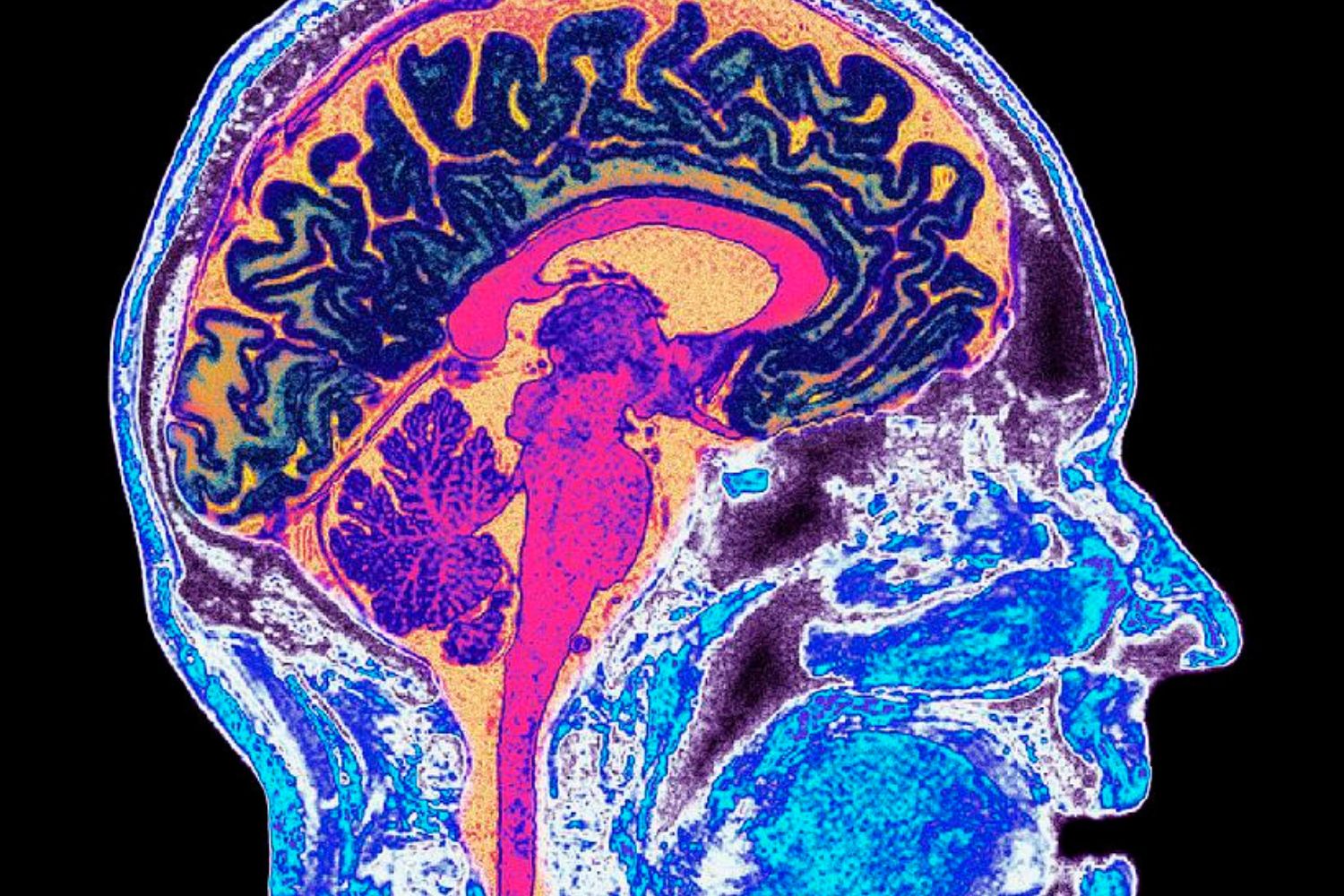 As cores que você vê todos os dias estão “hackeando” seu cérebro