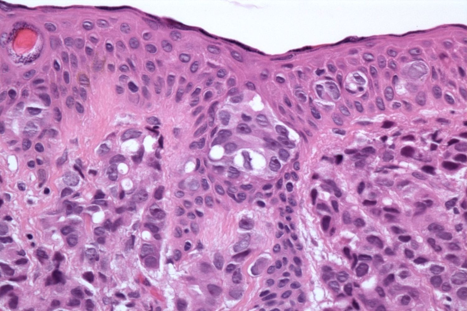 Adesivo sem bateria promete revolucionar o diagnóstico de câncer de pele