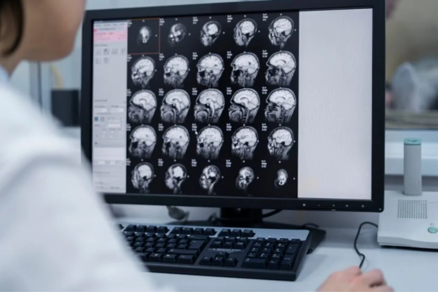 Doenças Neurológicas1