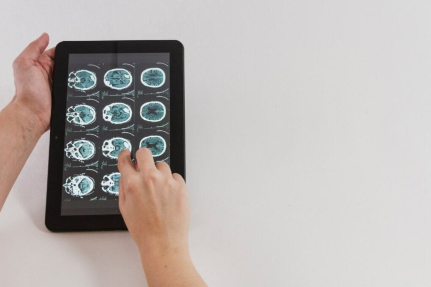 Segredo Do Cérebro2