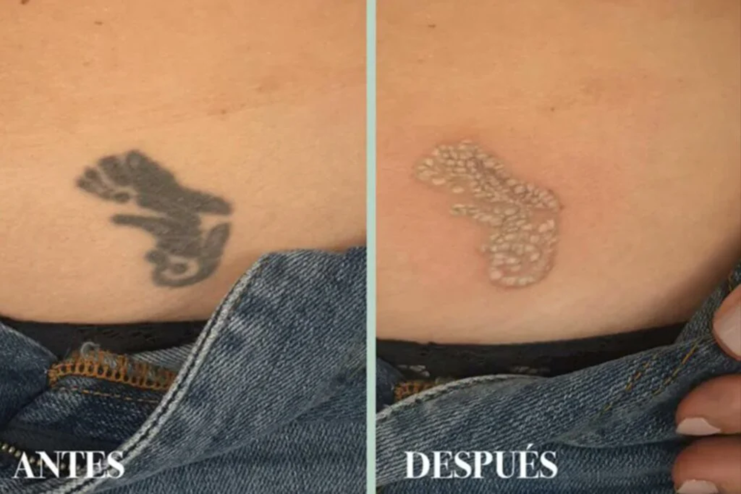 Cover Up1