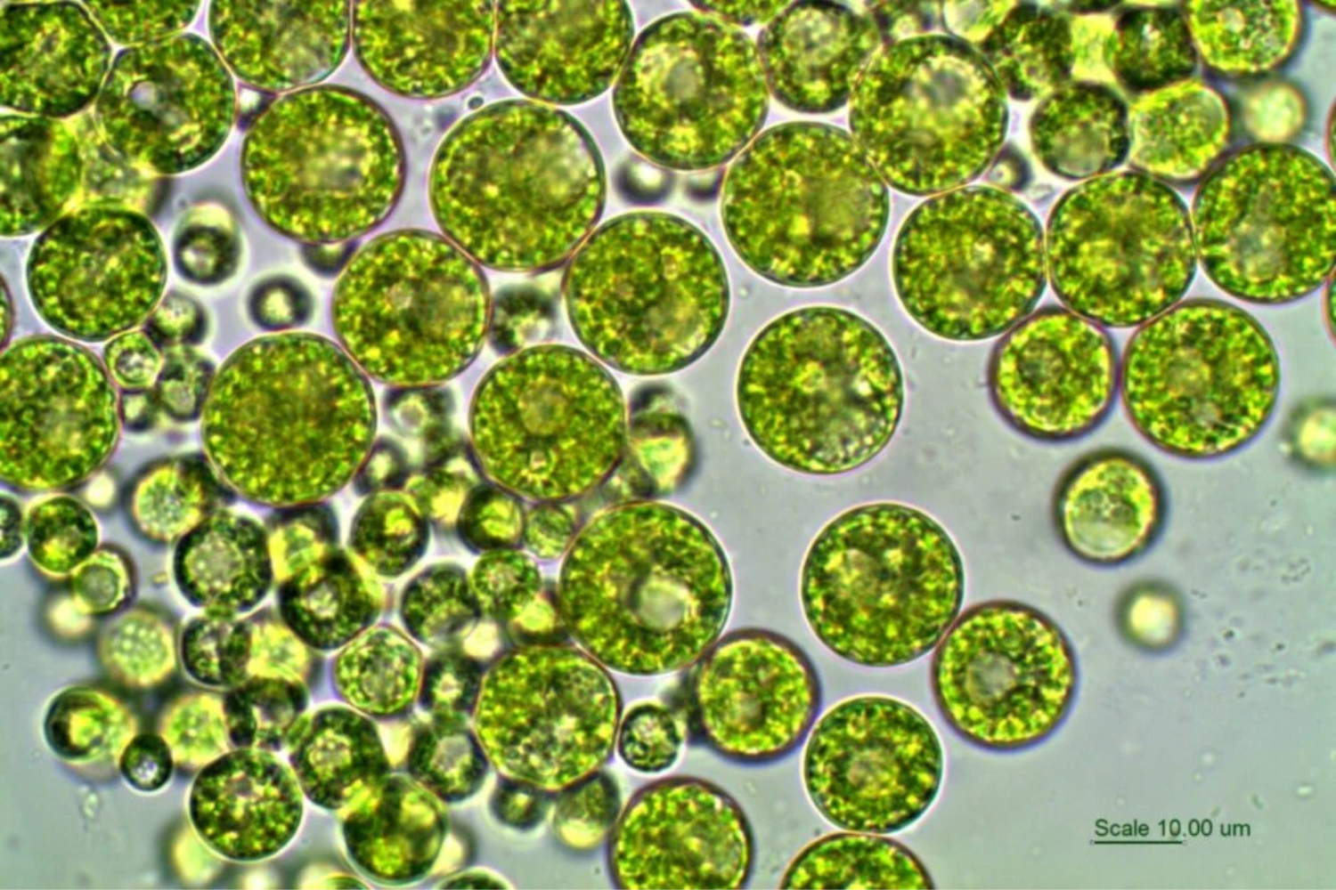 Microalgas
