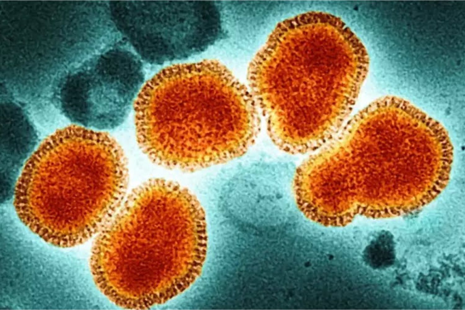 Surto de gripe H3N2 na Europa acende alerta para a América Latina
