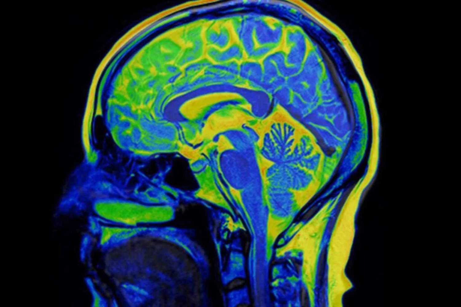 Cérebro Aprender Rápido