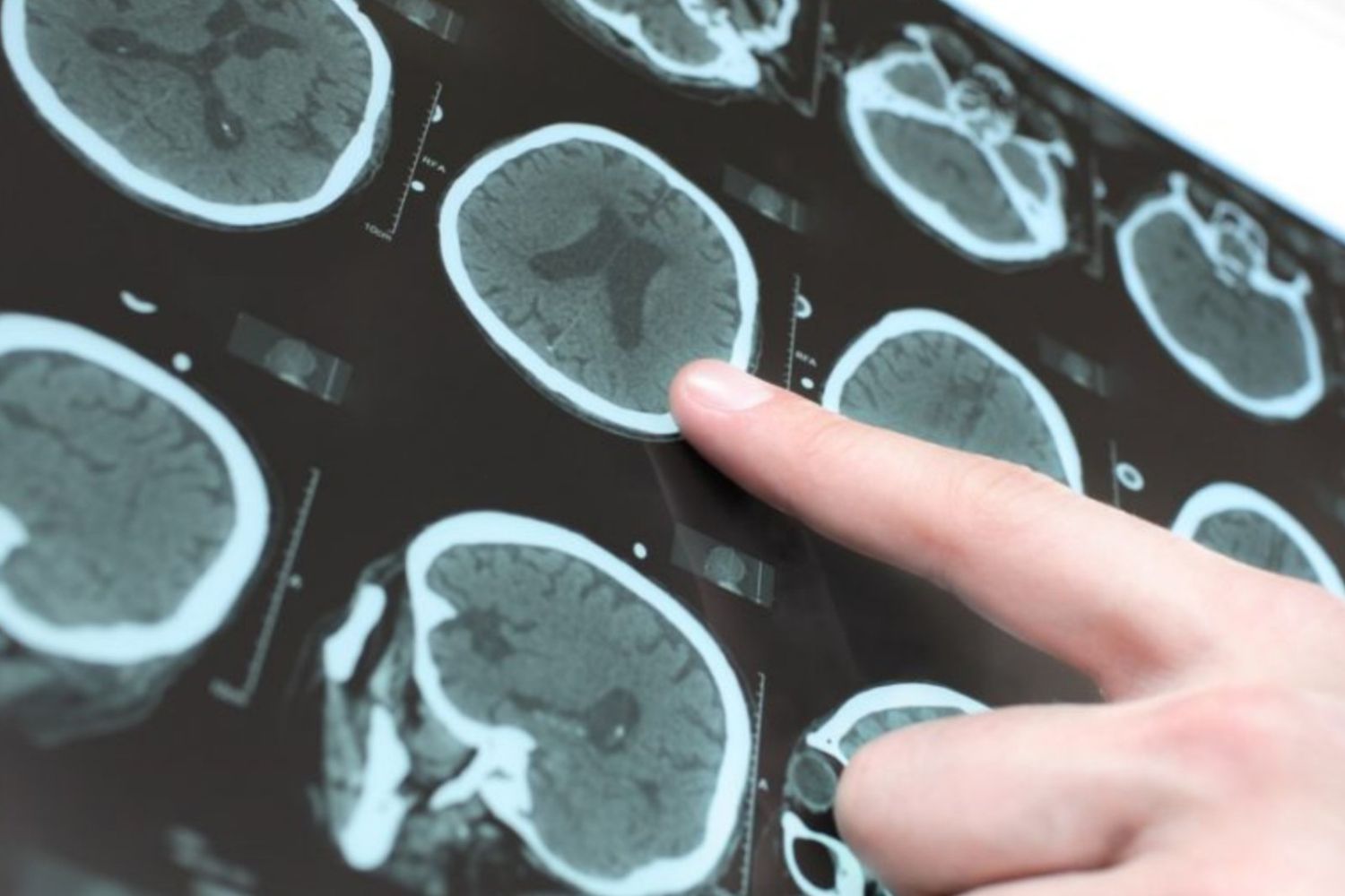 O impulso invisível que pode estar mudando a forma como o cérebro funciona