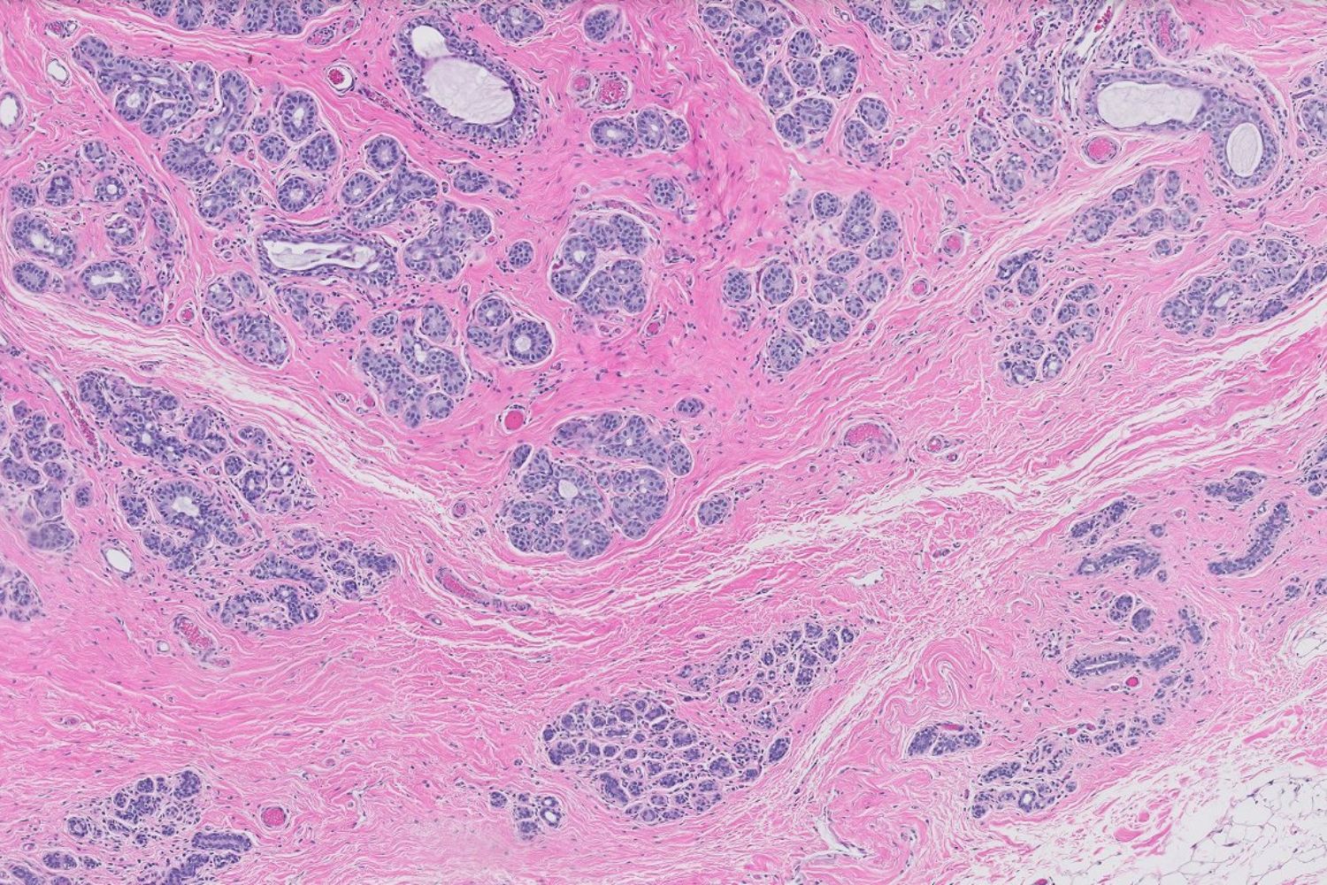 Após descobrir uma mutação genética de alto risco, uma mulher de 33 anos optou por uma cirurgia preventiva que mudou seu corpo