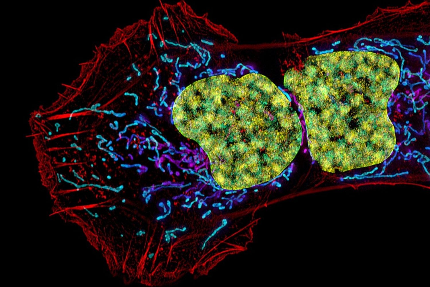 Uma injeção pode estar mudando o futuro da imunoterapia contra o câncer