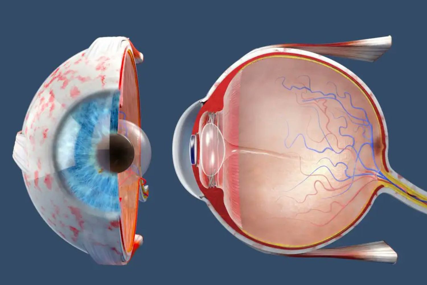 Um implante mais fino que cabelo pode mudar o futuro da visão
