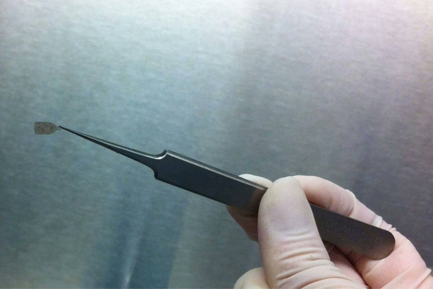 Um implante mais fino que cabelo pode mudar o futuro da visão