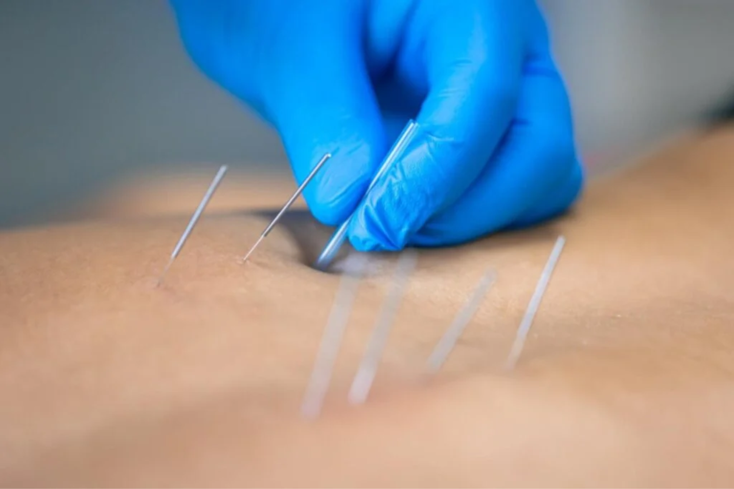 Alertas Na Medicina1