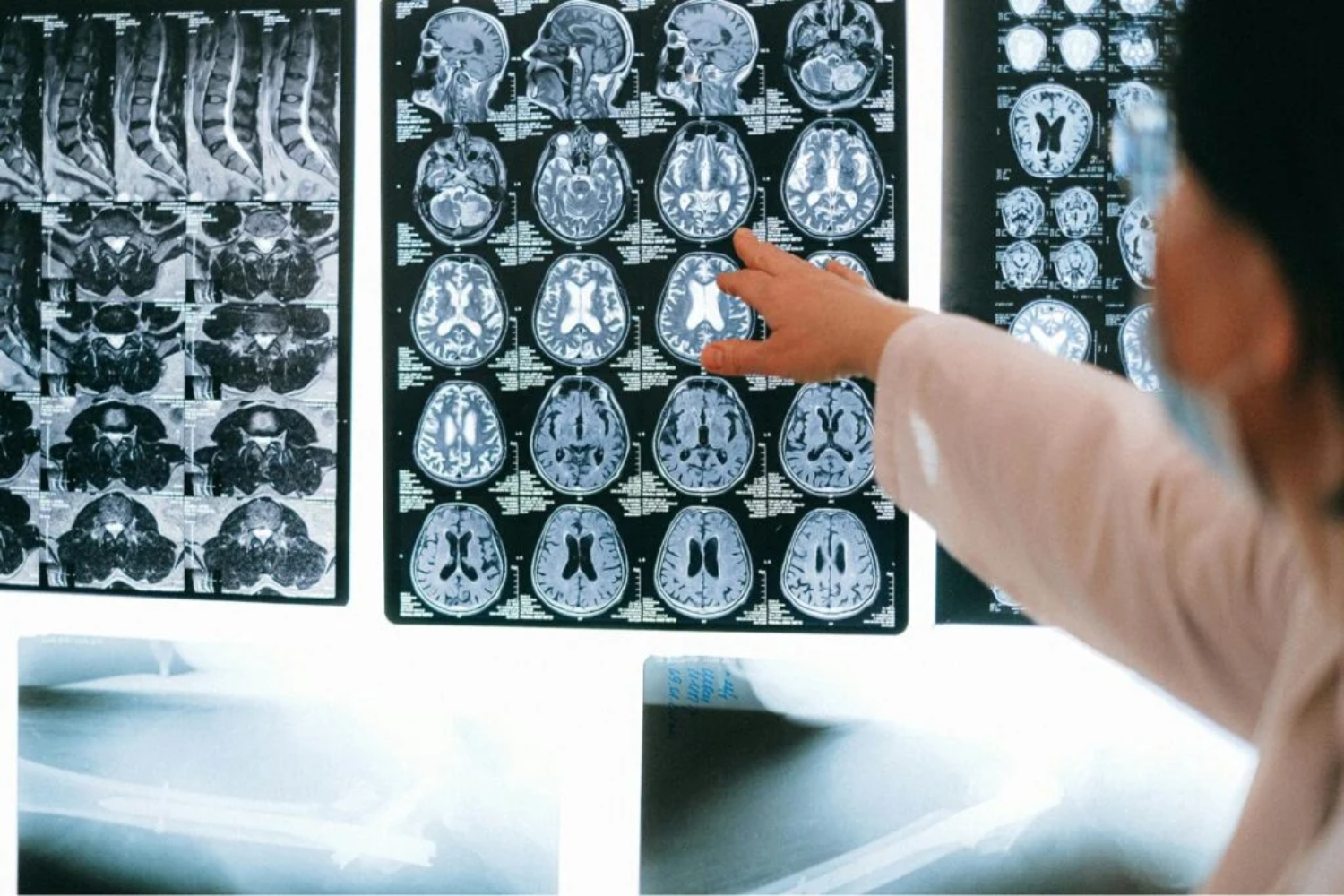 Novo Mapa Do Cérebro1