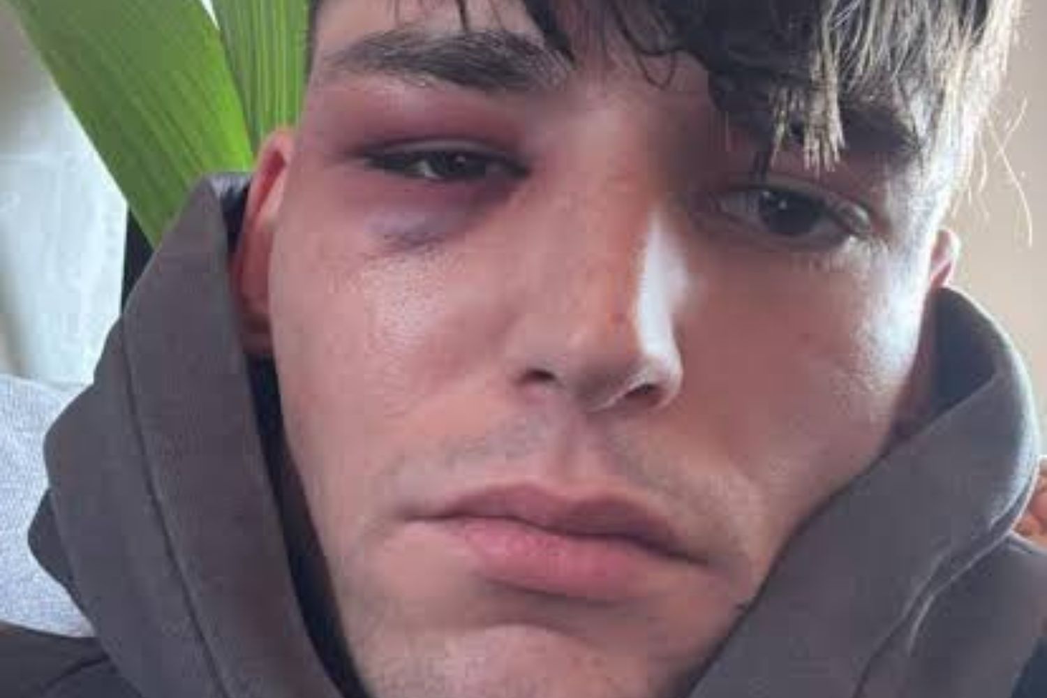 O momento que emocionou a Bundesliga e terminou em violência fora do estádio