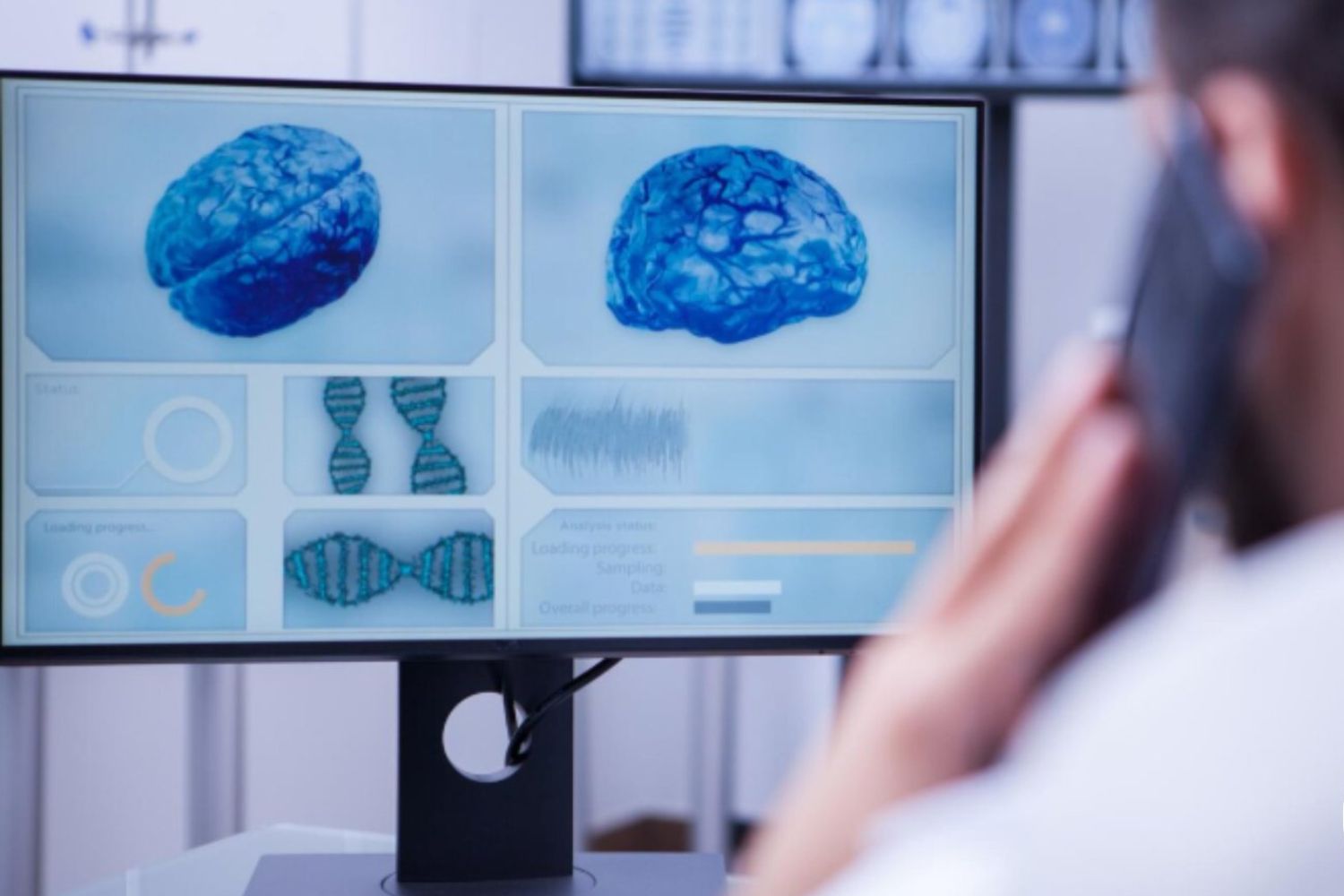 Uma nova IA promete revelar o que se esconde nas proteínas ligadas a doenças neurodegenerativas