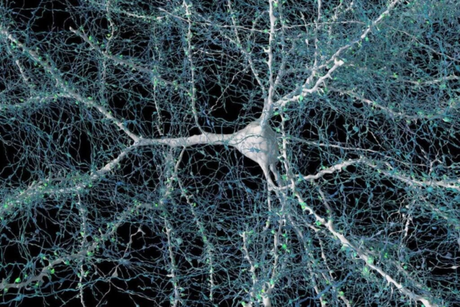 Derrame Cerebral1