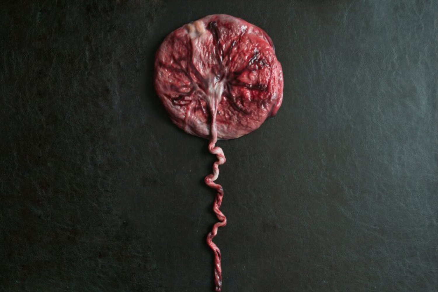 Desenvolvimento Do Cérebro Humano1