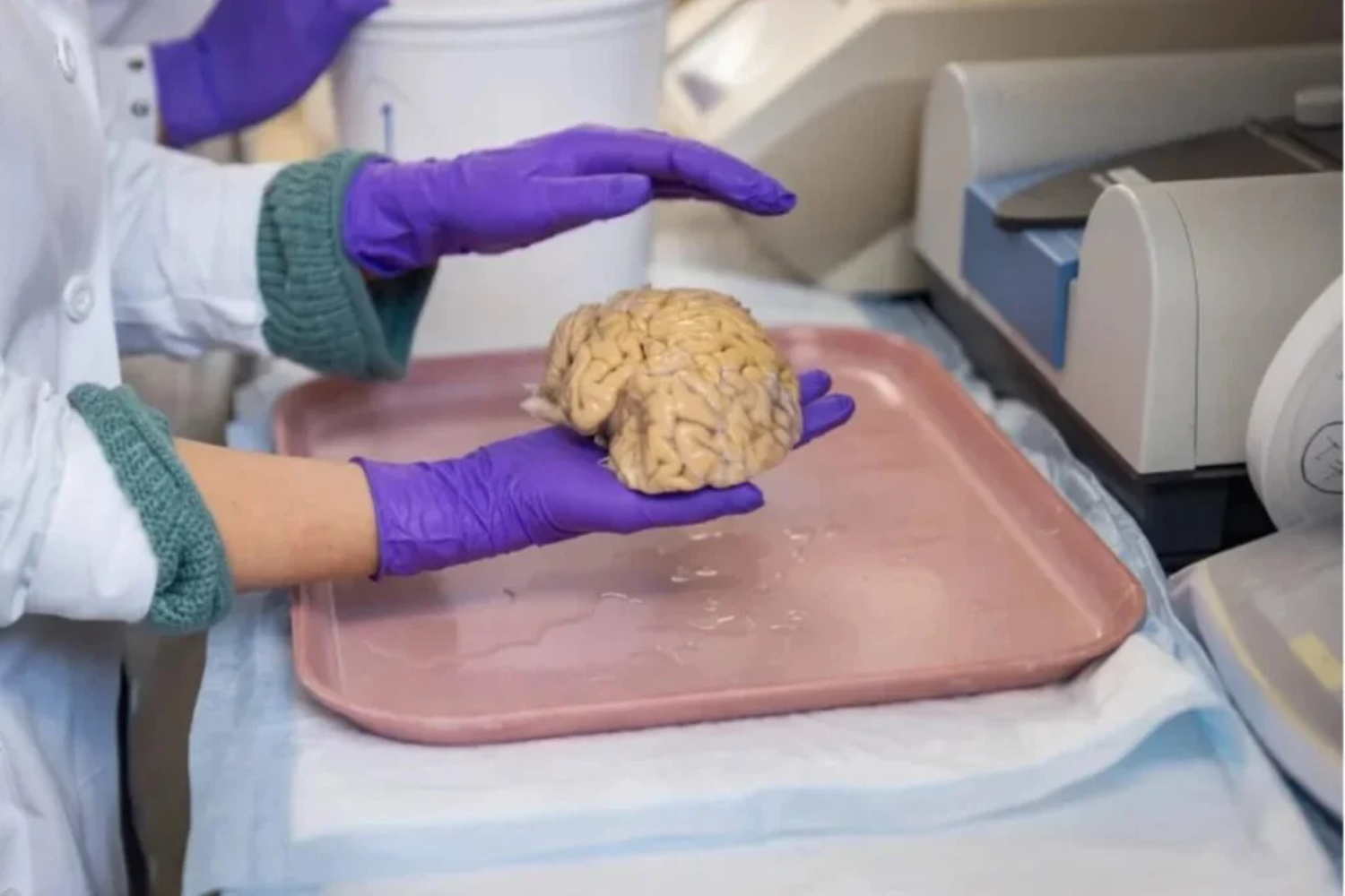 Regeneração Cerebral