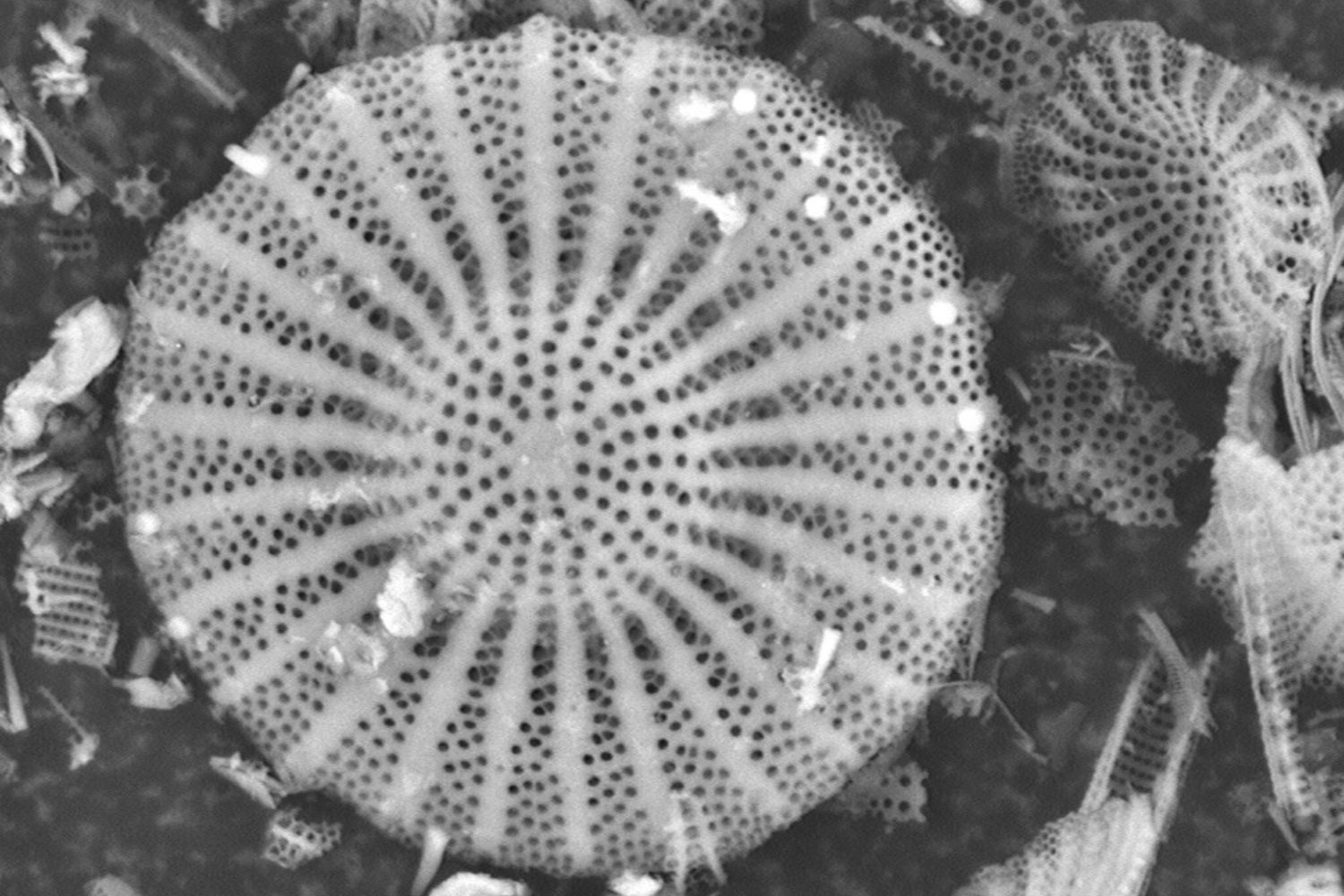 Esses organismos unicelulares gigantes parecem criaturas de outro planeta, mas vivem nas profundezas do oceano