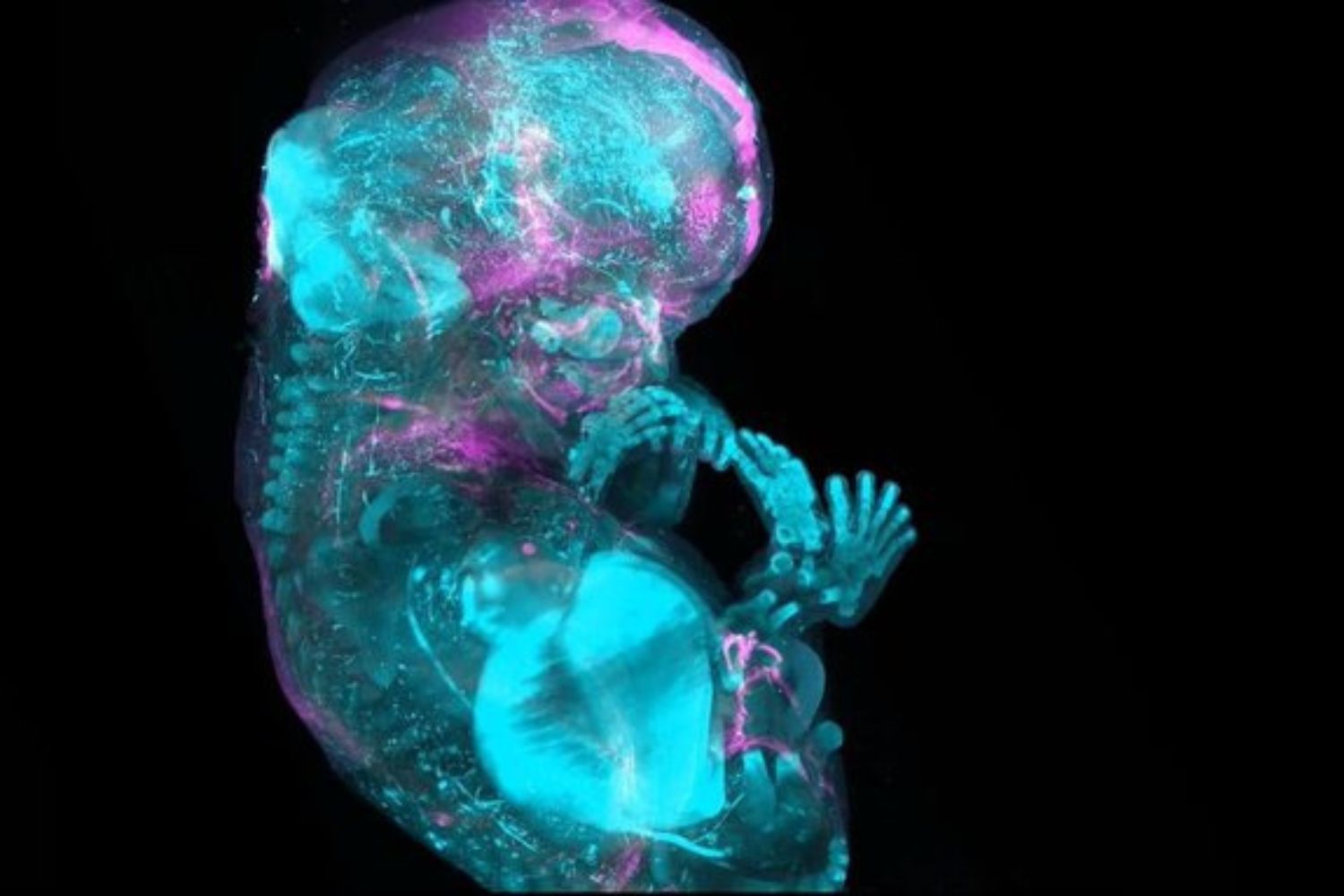 Cientistas acabam de criar algo parecido com um “Google Earth” do corpo humano — e ele pode mudar a medicina