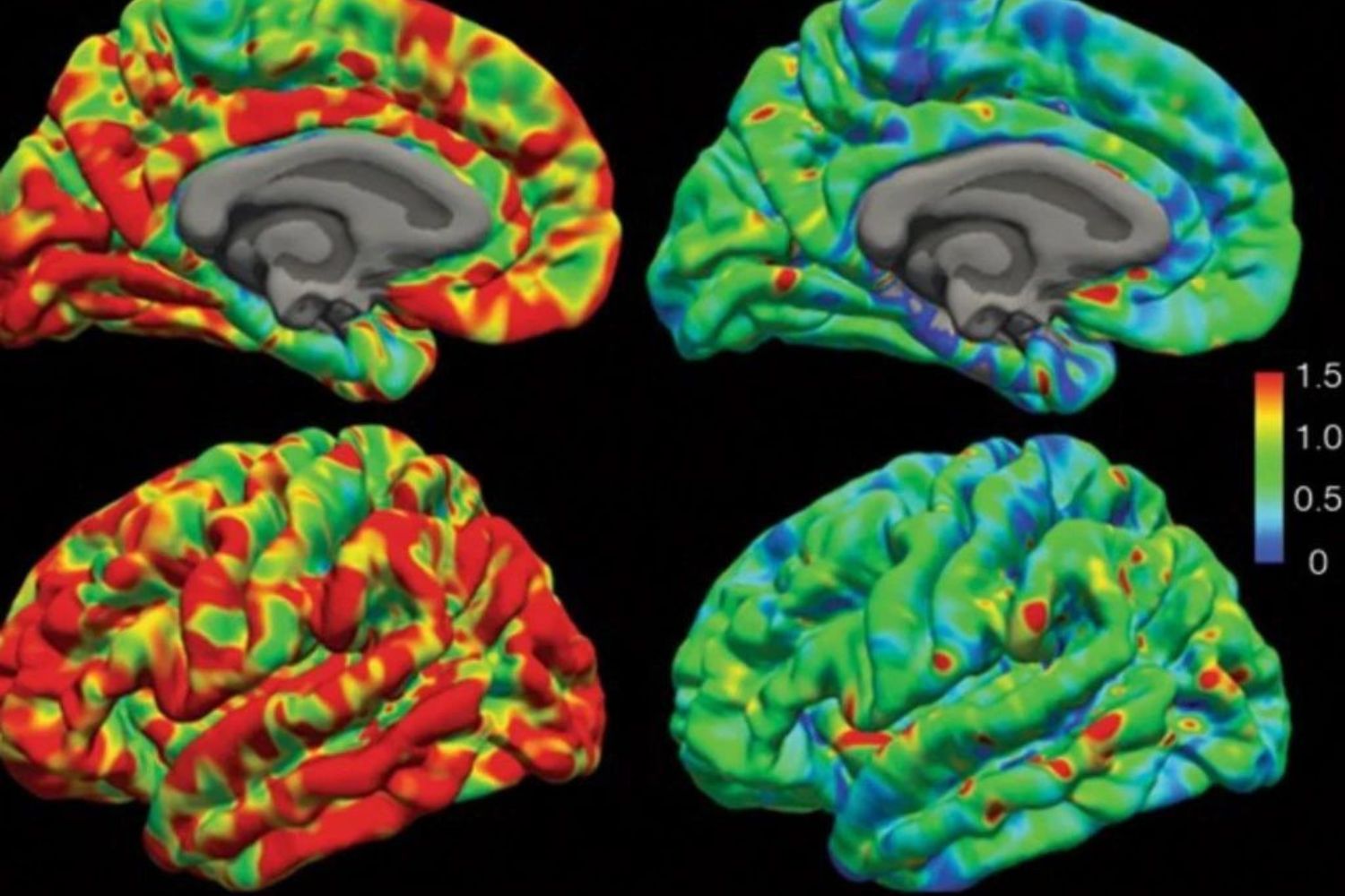 Cientistas aceleram testes de tecnologia que lê mentes