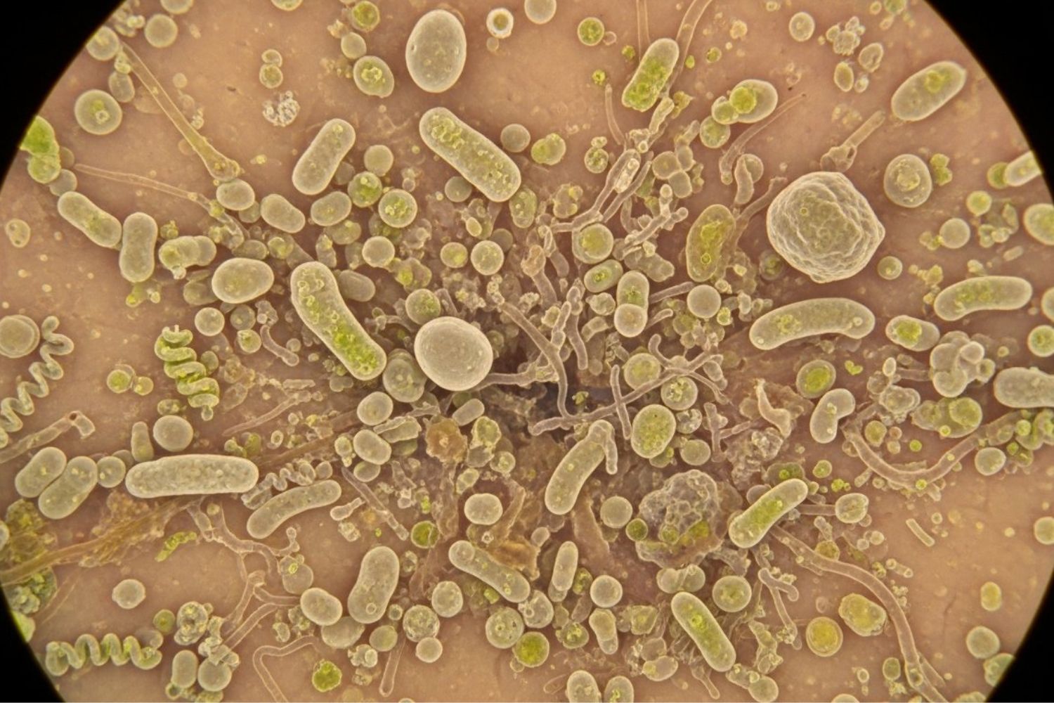 Casos de infecção por E. coli foram ligados a um tipo específico de queijo consumido nos EUA