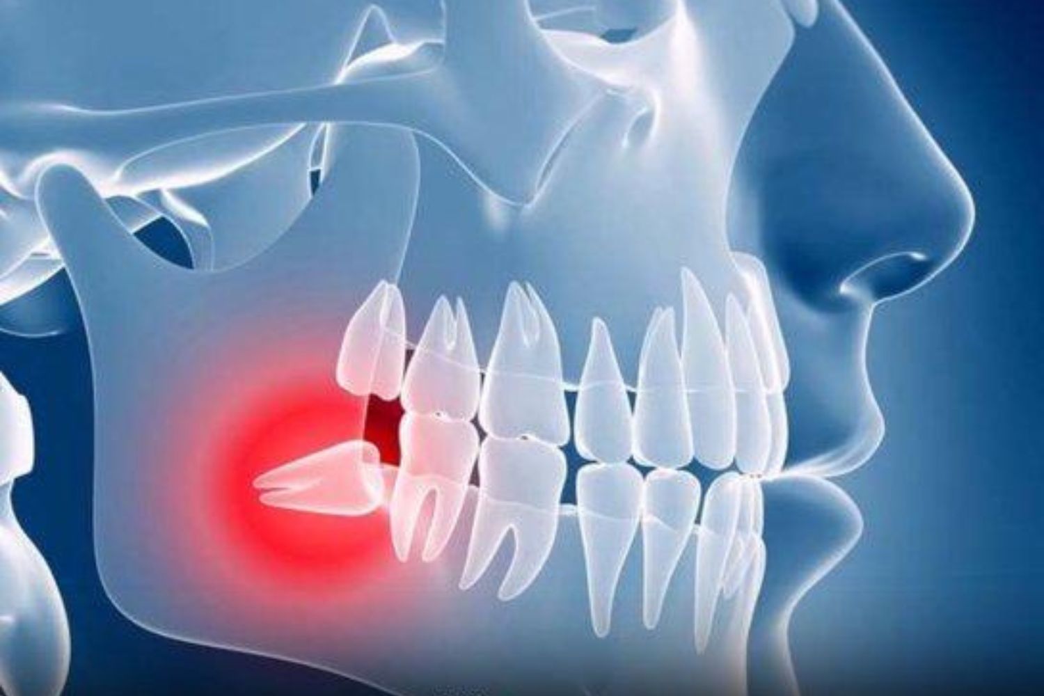 Nem todo mundo desenvolve os famosos dentes do siso: a ciência explica por quê