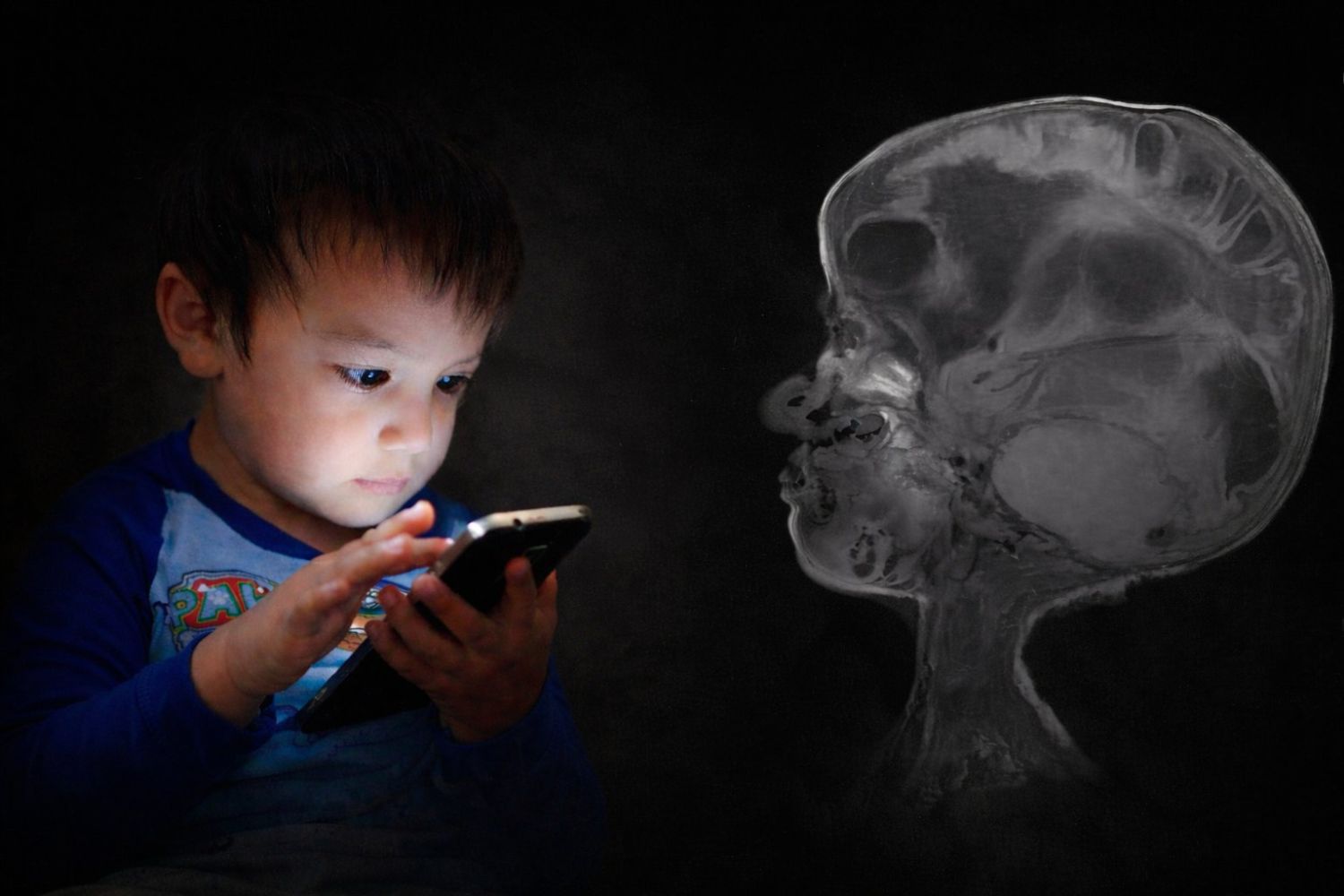 Autismo digital: especialistas alertam sobre efeitos do excesso de telas em crianças