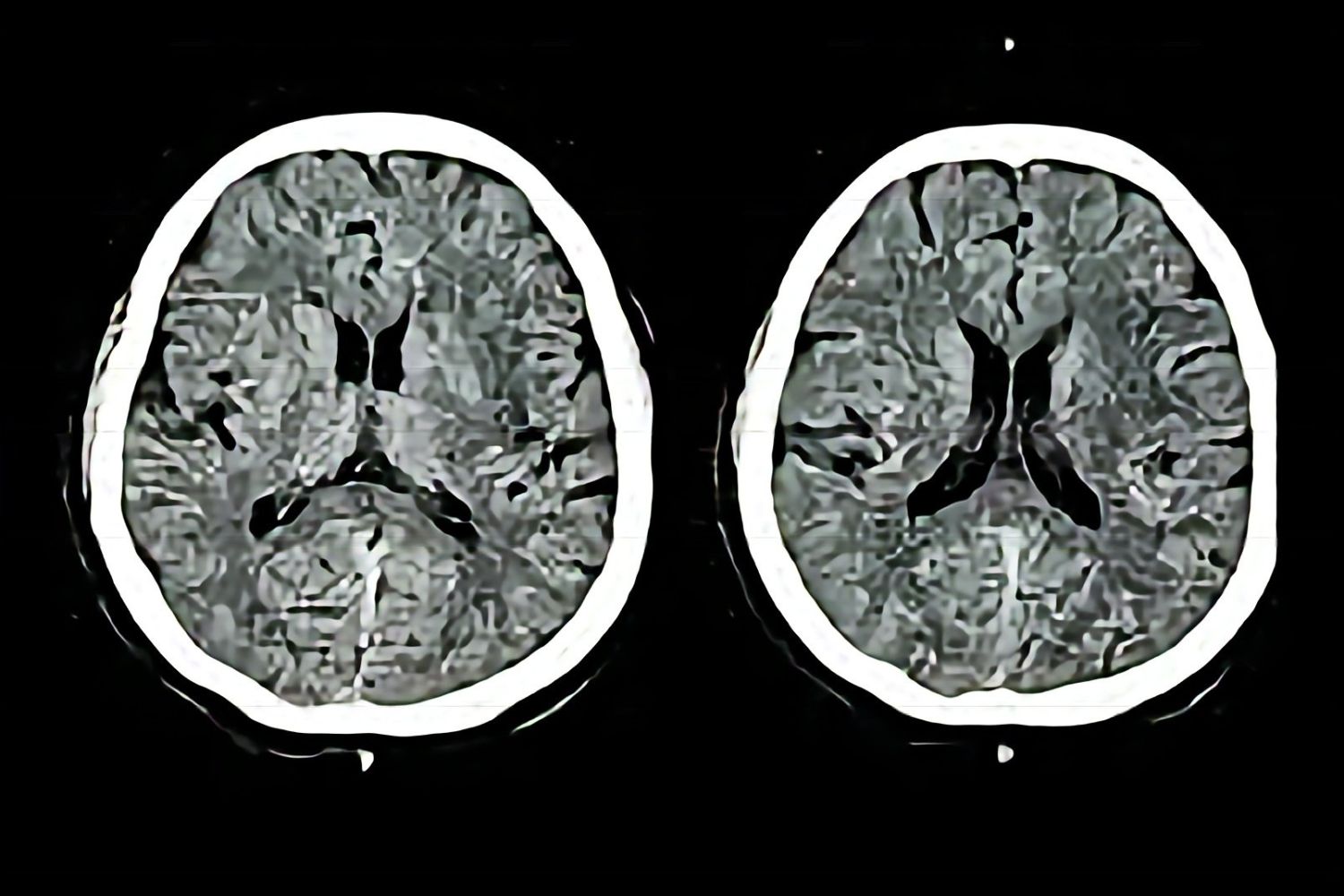 Não são palavras cruzadas: este hábito pode transformar seu cérebro muito mais rápido do que você imagina