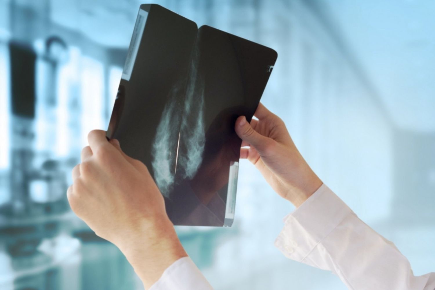 Uma IA detectou um câncer invisível ao olho humano