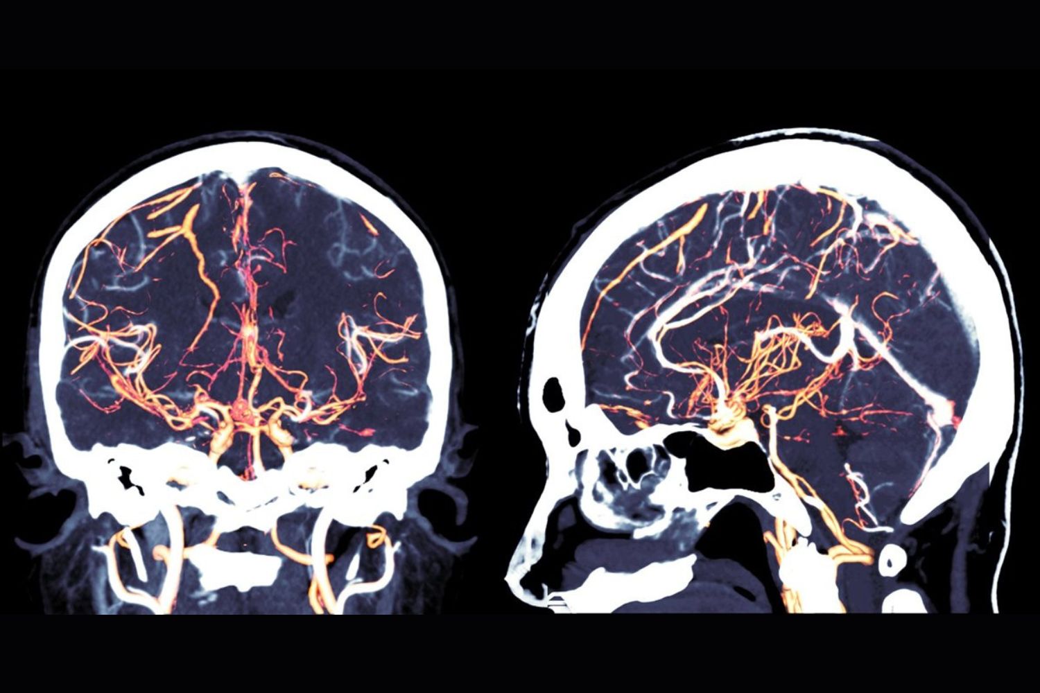 Cientistas desenvolvem neurobots com redes neuronais formadas espontaneamente