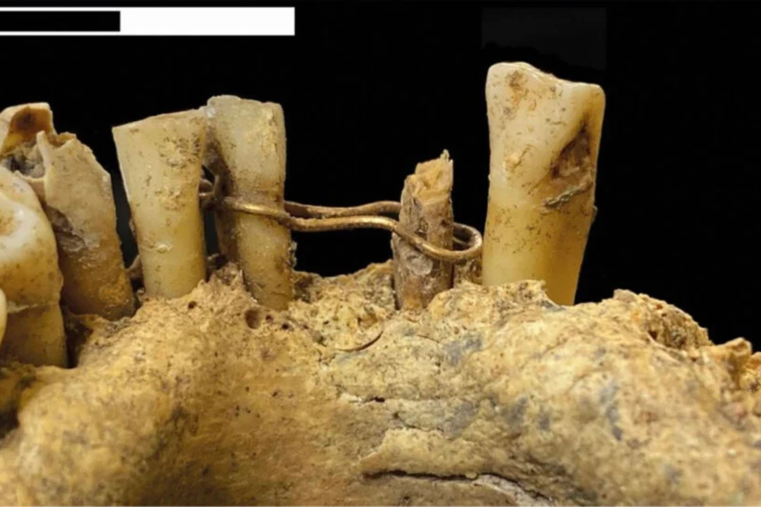 Dental Medieval 1