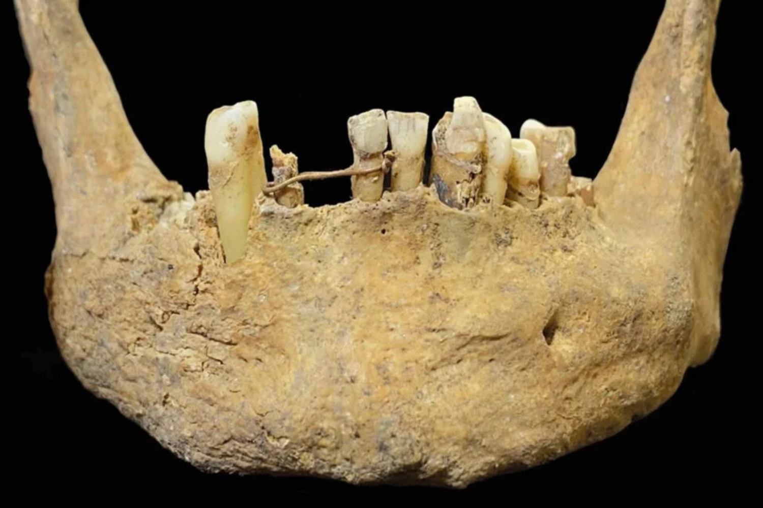 Dental Medieval P