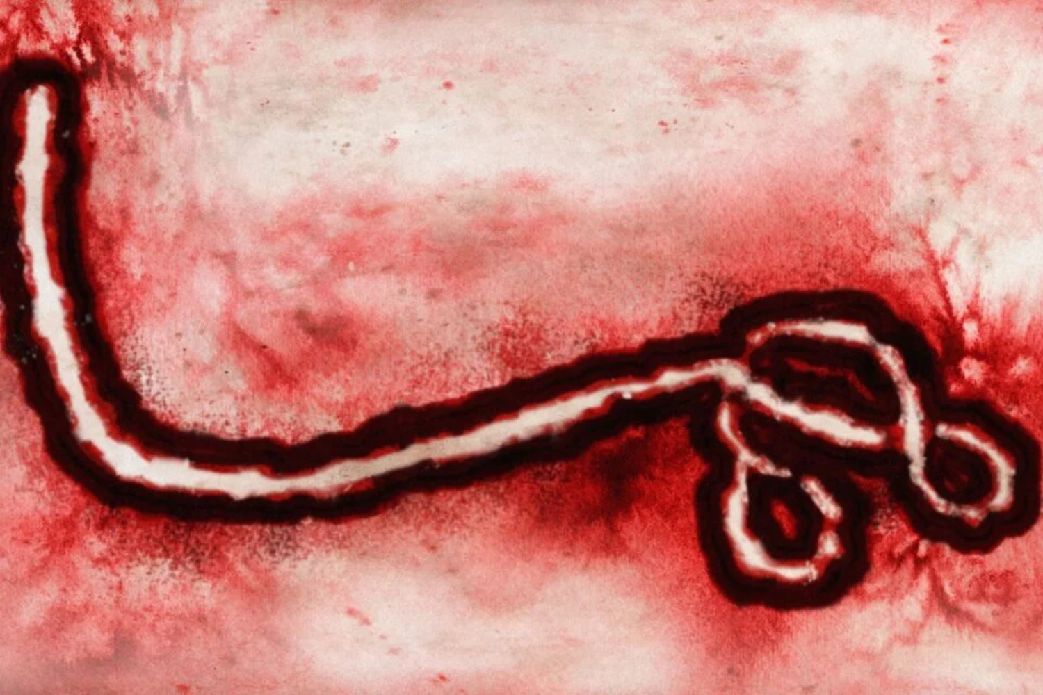 Ebola