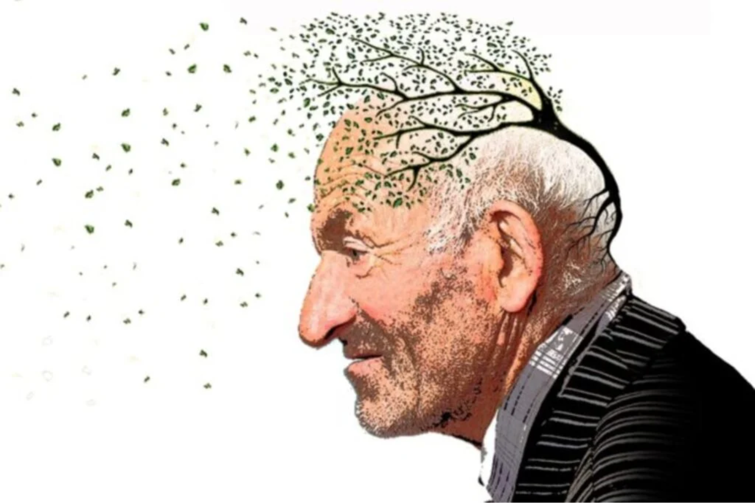 Casos De Parkinson