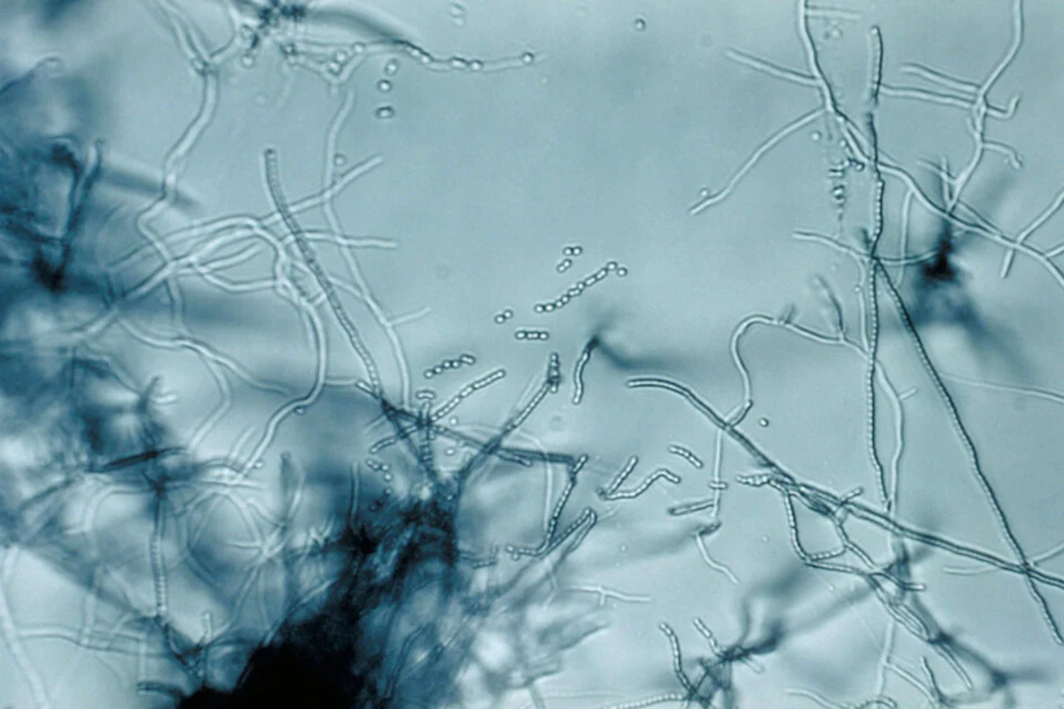 Bacterias