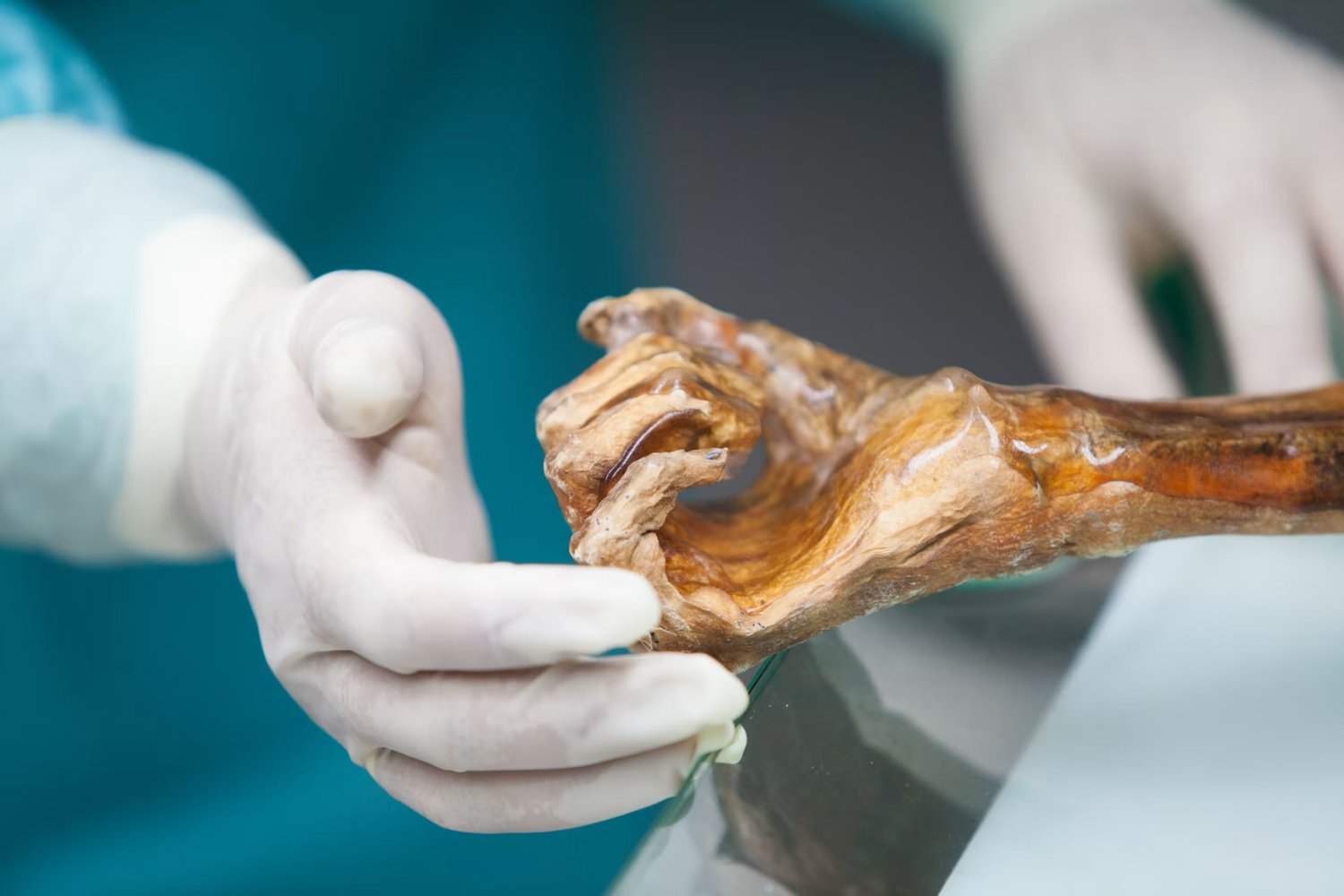 O Homem De Gelo Passou 5.300 Anos Congelado Nos Alpes. Agora Cientistas Descobriram Que Algo Dentro Dele Ainda Está Vivo