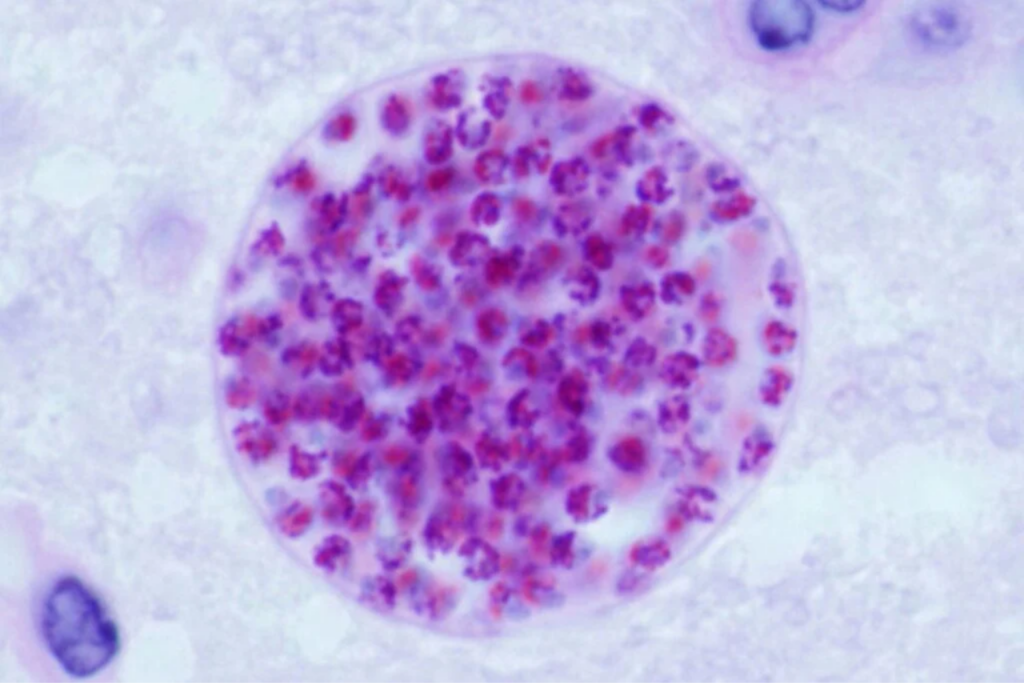 Parasita1