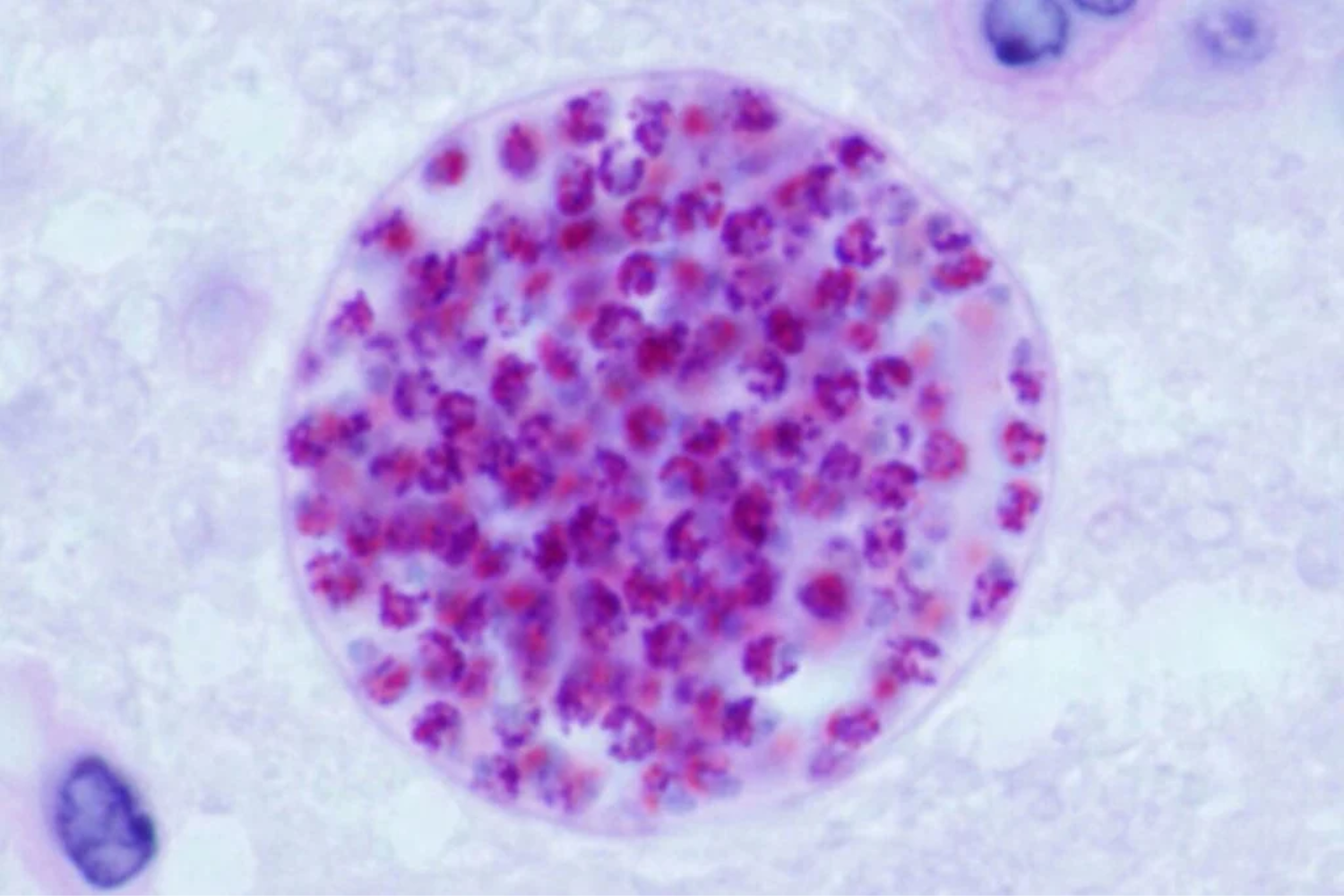 Parasita1