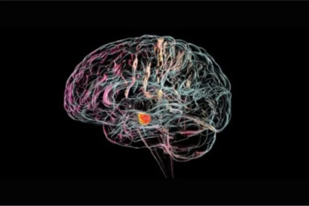 Chip Cerebral4