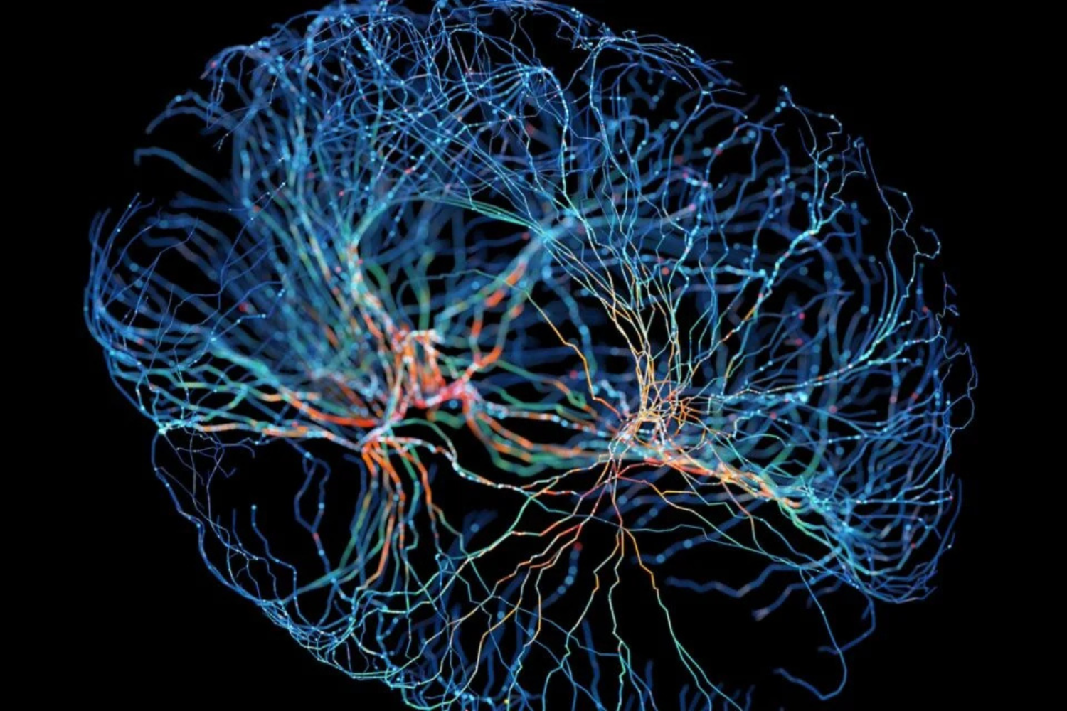 China Realiza O Primeiro Implante Comercial De Uma Interface Cérebro Computador E Avança Na Disputa Com A Neuralink