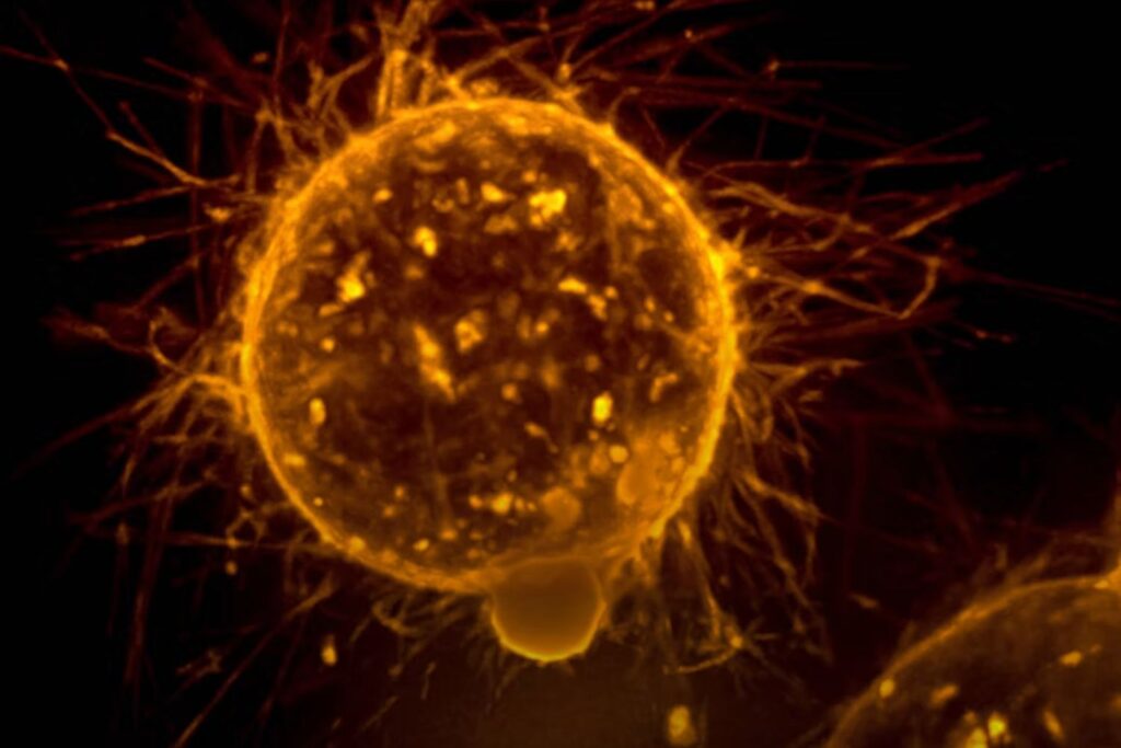 Nova tecnologia baseada em luz pode ajudar a eliminar células cancerosas "adormecidas"